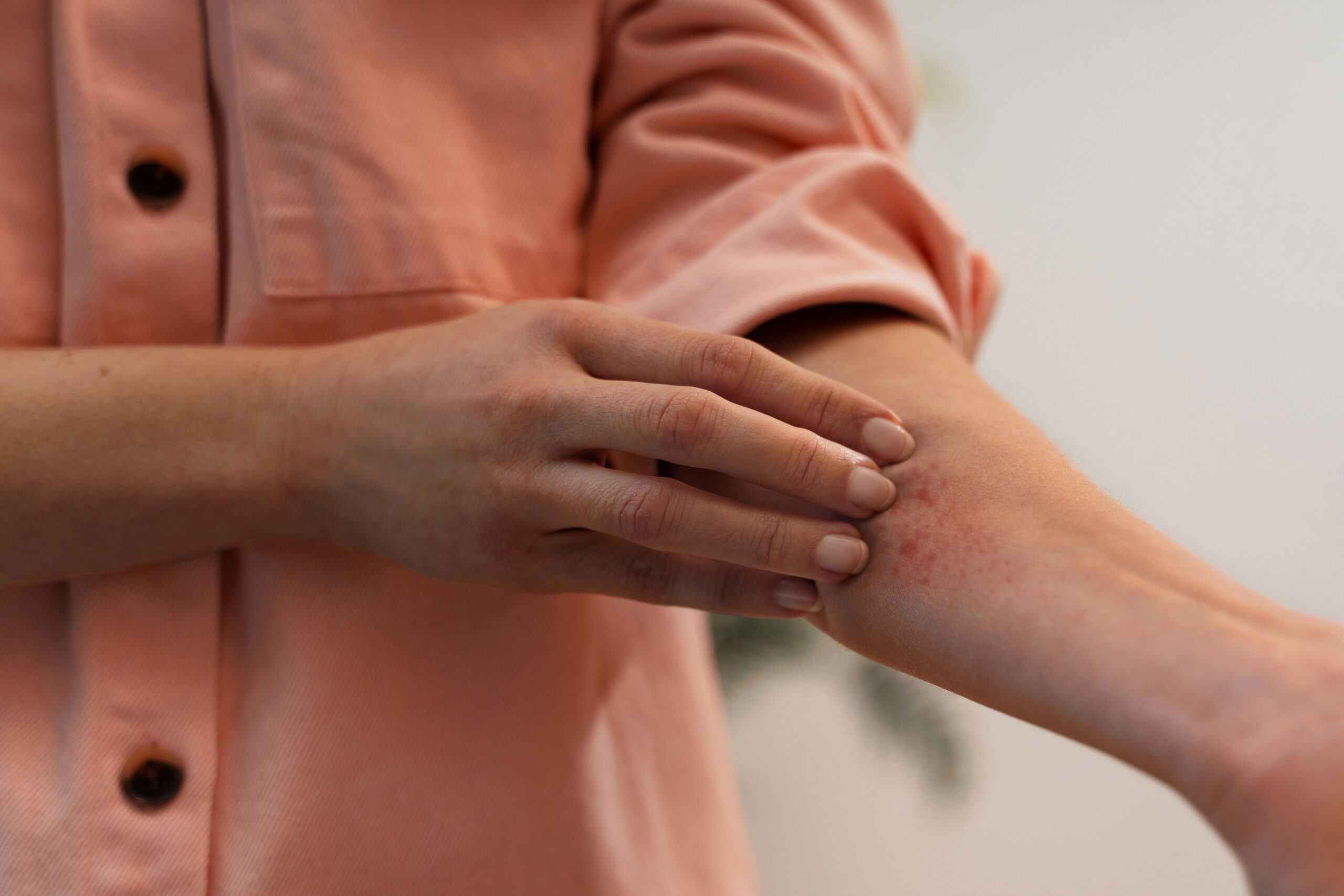 Struggles You May Have, if You Have Psoriasis