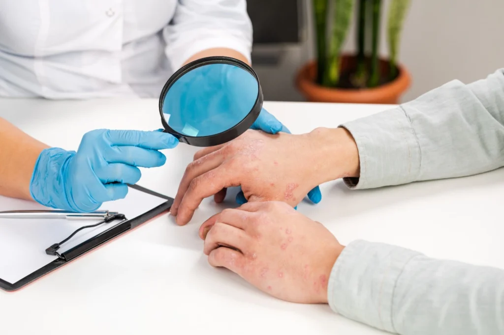 Book your consultation with Heal Psoriasis
